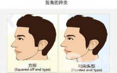 果酸换肤术做一次多少钱？