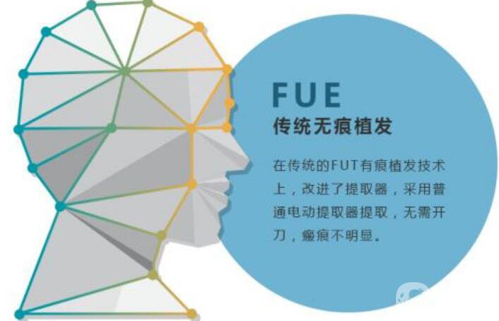 fue植发技术,*果