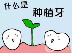 上海九院做一次种植牙价格是多少？价格贵吗？