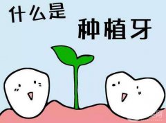 上海种植牙医院信息介绍呢?