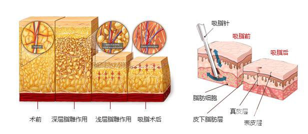 上海九院*价格 上海九院好不好