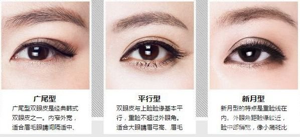 肿泡眼双眼皮贵吗 肿泡眼双眼皮手术的价格