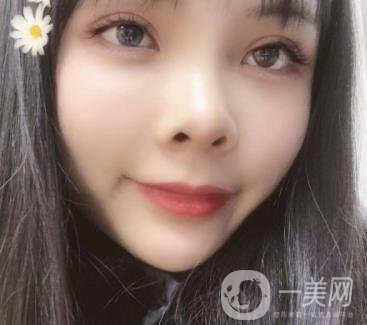 西安交通大学附属医院整形美容科价格表和双眼皮案例一览