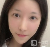 成都华美医院做眉毛怎么样?真实果图和价格一览表展示