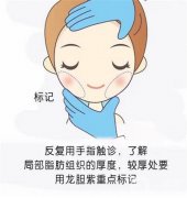 抽脂减肥后的疼痛怎么缓解？面部可以抽脂吗？