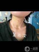 脖子真的就是女人的第二张脸，所以大家在保养自己脸蛋的同时，也不要忘记自