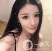 玻尿酸注射后的第一天，很好看，我是那种追求小V的女生