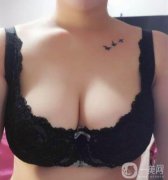 在严重的情况下对女性泌乳后期也有一定的影响，所以副乳切除是重要的