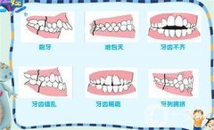 地包天后需要注意什么