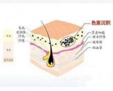 彩光嫩肤可以解决哪些皮肤问题？